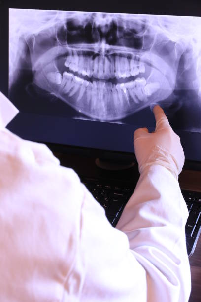 Best Emergency Tooth Extraction in Winchester, KY