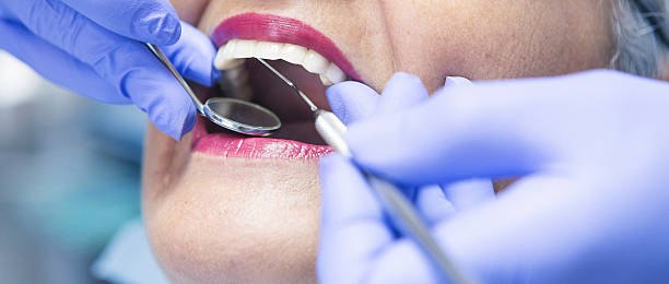 Best Emergency Wisdom Teeth Removal in Winchester, KY